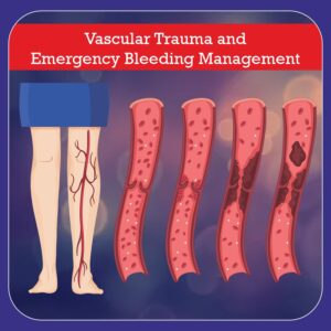 vascular trauma